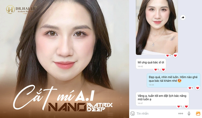 Cắt mí A.I Nano Matrix Deep thực hiện quy trình chuẩn y khoa mang lại sự hài lòng đến khách hàng