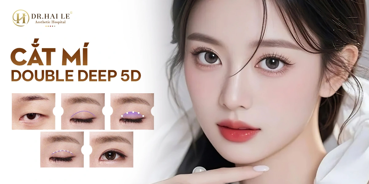 Cắt mí Double Deep 5D tại Bệnh viện Thẩm mỹ Dr.Hải Lê – kỹ thuật bóc tách đa lớp, mở điểm rơi mí tự nhiên, khắc phục mí sụp – mí không đều – mí lỗi hỏng.