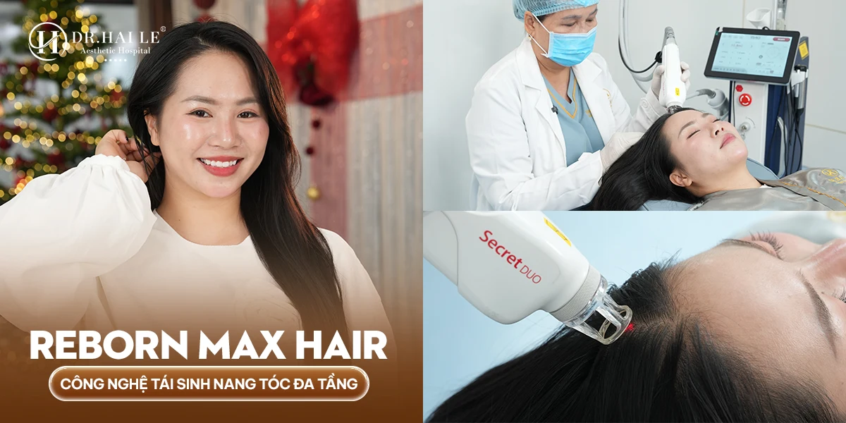Điều trị rụng tóc chuẩn y khoa – phục hồi nang tóc từ gốc