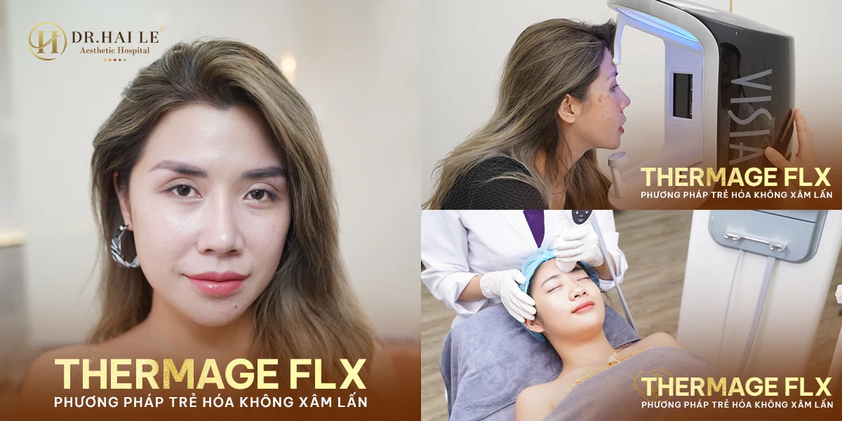 Nâng Cơ Thermage 1 Nâng cơ Thermage – trẻ hóa da không xâm lấn, an toàn chuẩn y khoa