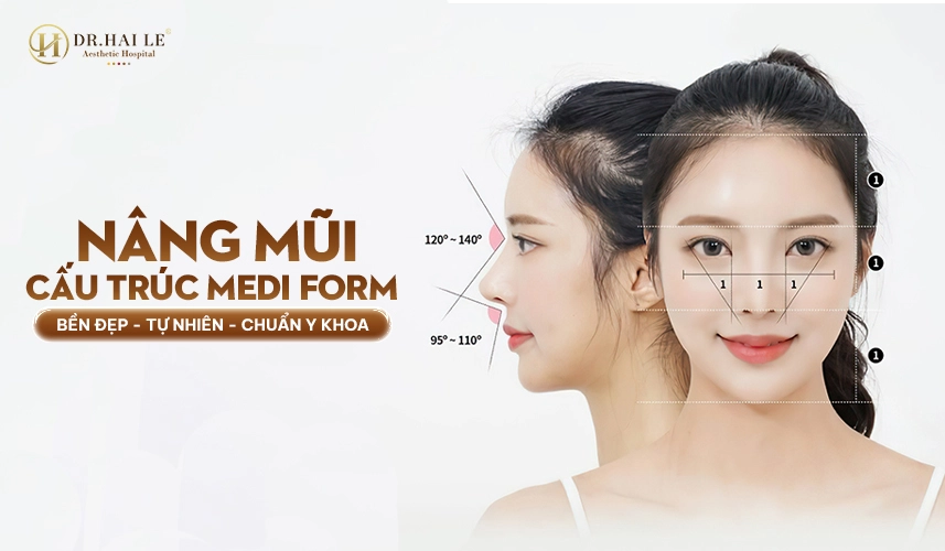 Nâng Mũi Cấu Trúc Medi-Form 2 Nâng mũi cấu trúc Medi-Form – tái cấu trúc toàn diện dáng mũi chuẩn y khoa