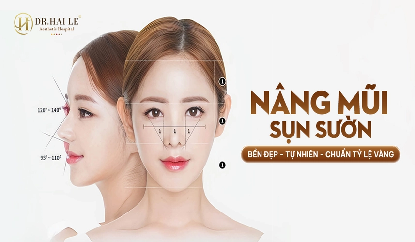 Nâng Mũi Cấu Trúc Sụn Sườn 2 Bệnh viện Thẩm mỹ Dr.Hải Lê – địa chỉ nâng mũi cấu trúc sụn sườn chuẩn y khoa, an toàn và bền vững