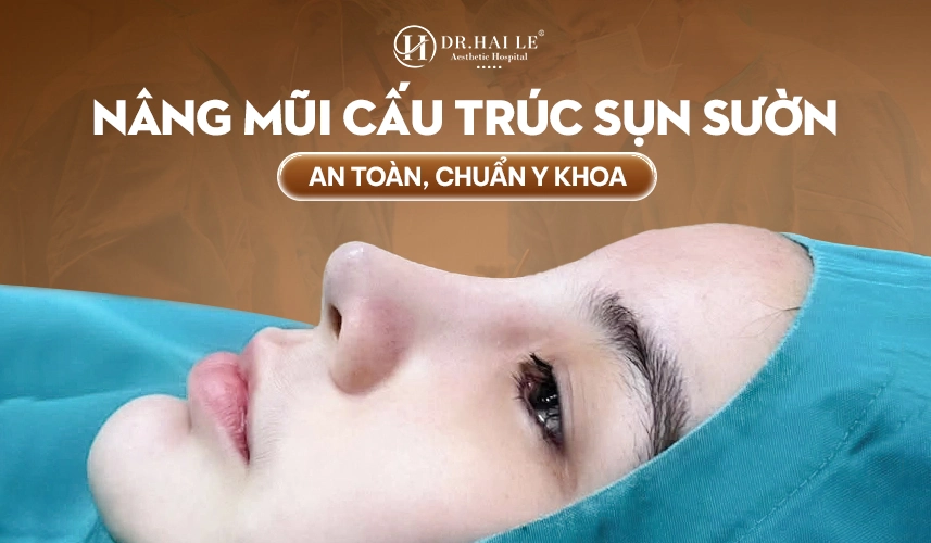 Nâng mũi sụn sườn giúp dáng mũi cao tự nhiên, không bóng đỏ