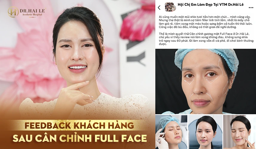Quy trình cân chỉnh Full Face được thực hiện trong môi trường đạt chuẩn y khoa, an toàn tuyệt đối