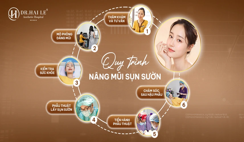 Nâng Mũi Cấu Trúc Sụn Sườn 3 Phẫu thuật nâng mũi sụn sườn được thực hiện trong phòng mổ vô khuẩn đạt chuẩn bệnh viện