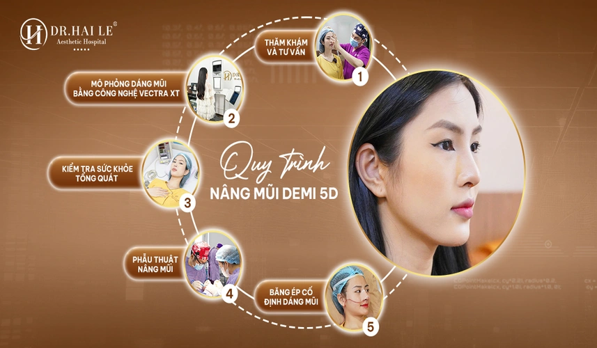 Phẫu thuật nâng mũi Demi 5D trong phòng mổ vô khuẩn chuẩn bệnh viện