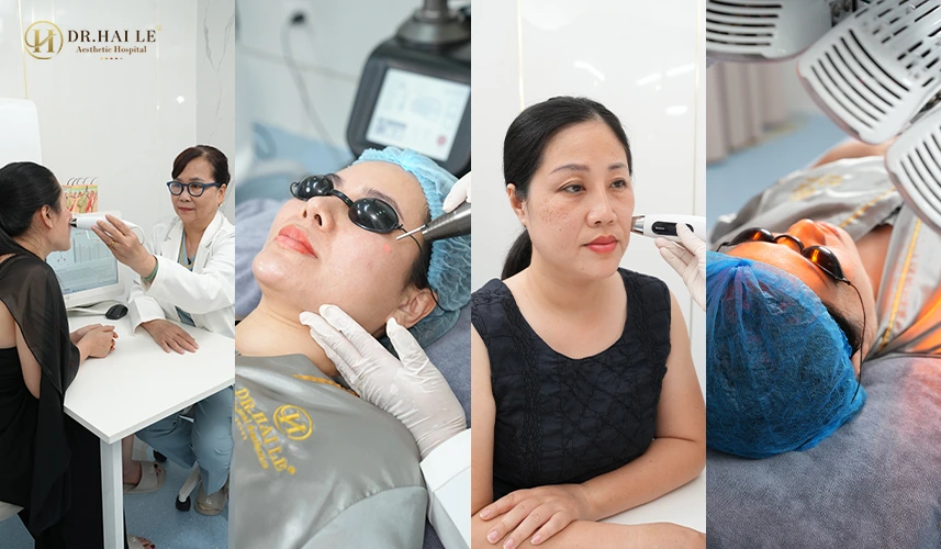 Liệu trình trị nám được cá nhân hóa theo từng cơ địa và tình trạng da cụ thể