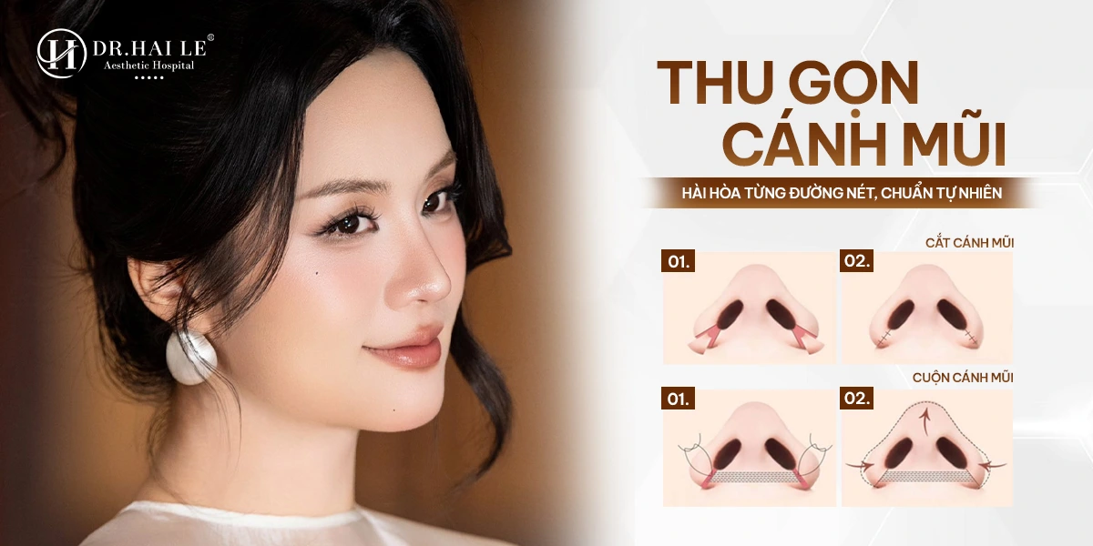 Cánh mũi sau thu gọn cân đối, mềm mại, không lộ dấu vết can thiệp