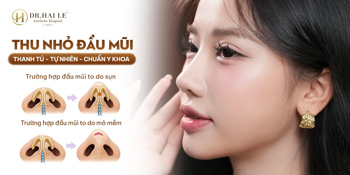 Thu Nhỏ Đầu Mũi 1 Thu nhỏ đầu mũi giúp tối ưu form mũi tổng thể, tạo dáng mũi thanh tú và cân đối hơn