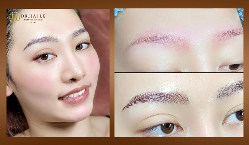 Trước & sau điêu khắc mày: dáng mày rõ nét – gương mặt hài hòa