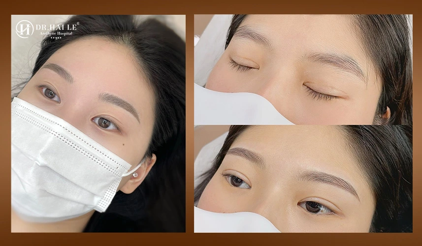 Trước & sau phun mày: gương mặt cân đối, sắc nét hơn
