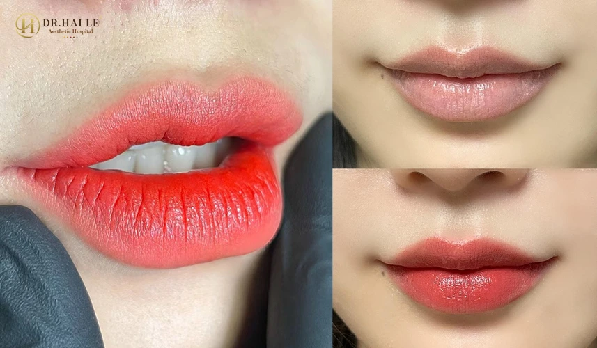 Phun môi giải pháp cải thiện môi thâm – nhạt màu – kém sức sống