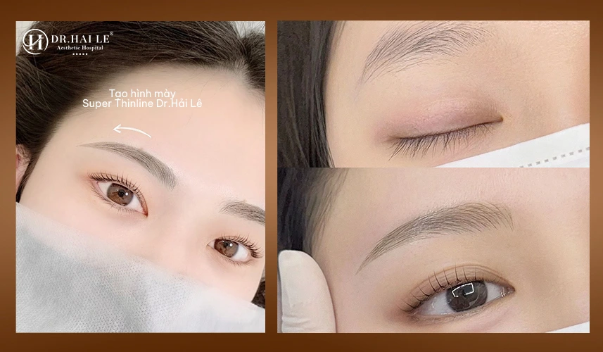 Trước: mày lệch – rối – thiếu khung | Sau: dáng mày gọn gàng, cân đối và tinh tế
