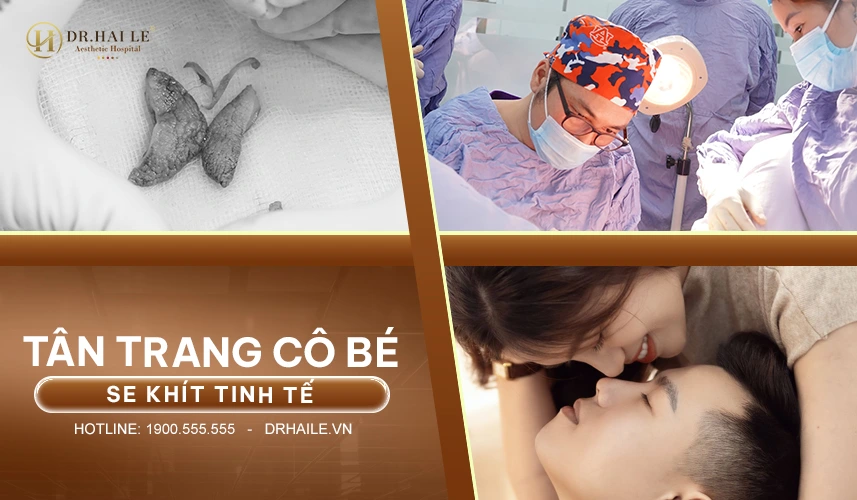Công nghệ hiện đại giúp thẩm mỹ vùng kín nhẹ nhàng, hồi phục nhanh
