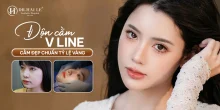 Độn cằm V-Line giúp hoàn thiện đường nét, nâng tầm thần thái gương mặt