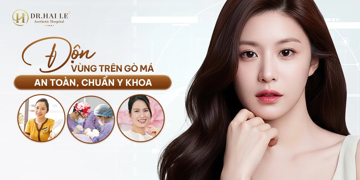 Độn vùng trên gò má chuẩn y khoa giúp nâng đỡ vùng mắt – má – rãnh mũi má hài hòa.