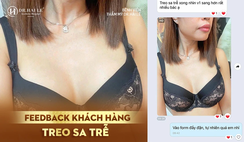 Tạo Hình Ngực Sa Trễ 4 Khách hàng được theo dõi sát sao và hướng dẫn chăm sóc chuẩn y khoa