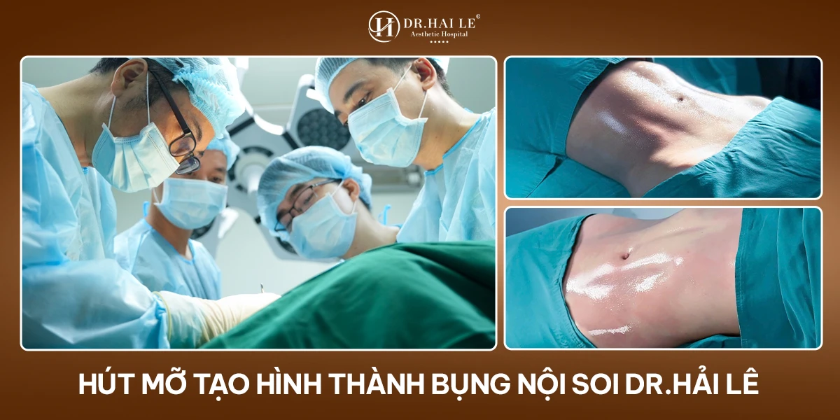 Hút mỡ tạo hình thành bụng tái cấu trúc vùng bụng Dr.Hải Lê