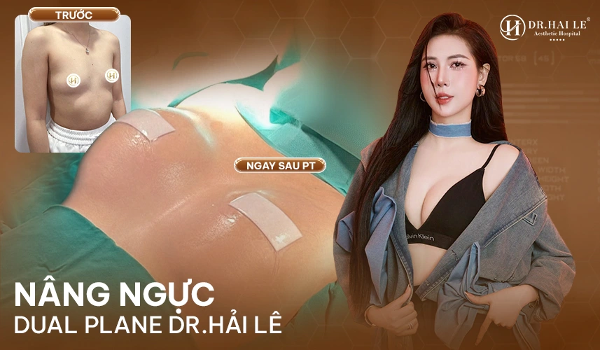Cá nhân hóa size túi – dáng túi – vị trí đặt túi cho từng khách hàng