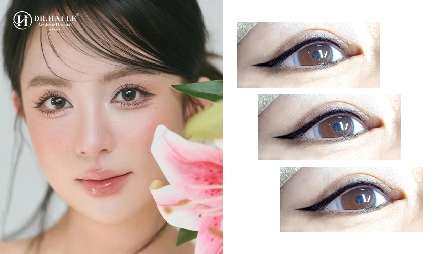 Quy trình phun mí chuẩn y khoa tại Dr.Hải Lê