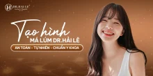Tạo hình má lúm – điểm nhấn duyên dáng cho nụ cười tự nhiên