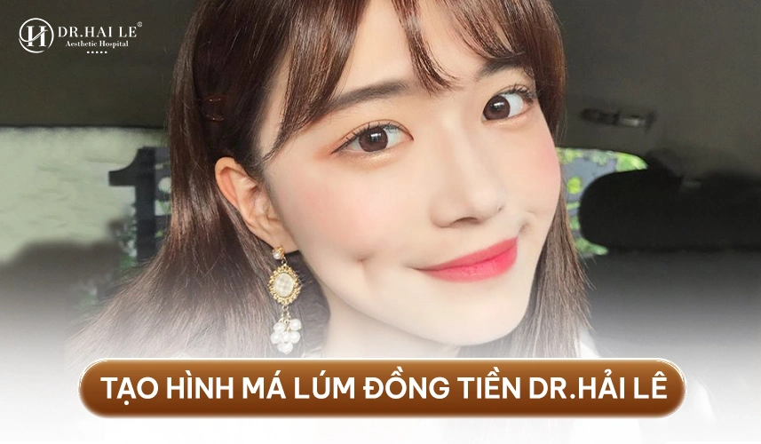 Tạo hình má lúm – nhẹ nhàng, an toàn, không để lại sẹo