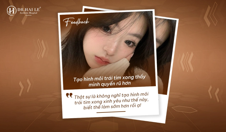 Tạo hình môi trái tim tại Dr.Hải Lê – tinh tế, tự nhiên, chuẩn y khoa