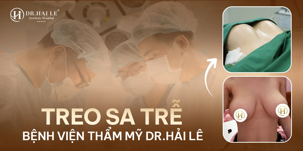 Tạo hình ngực sa trễ chuẩn y khoa giúp nâng cao bầu ngực chảy xệ