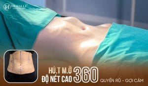 Công nghệ hút mỡ độ nét cao 360 hiện đại
