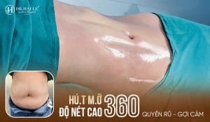 Bụng mỡ được công nghệ hút mỡ độ nét cao 360 đánh bay