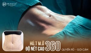 Khách hàng sau khi hút mỡ độ nét cao 360