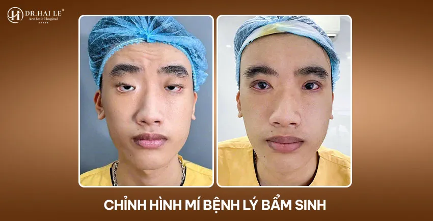 Video thumb