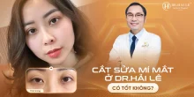 Cắt sửa mí mắt ở Dr.Hải Lê có tốt không?