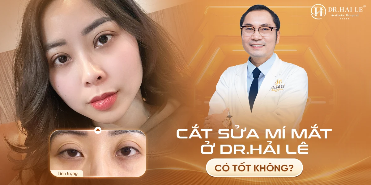 Cắt sửa mí mắt ở Dr.Hải Lê có tốt không? 1 Cắt sửa mí mắt ở Dr.Hải Lê có tốt không?
