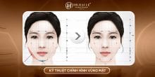Kỹ thuật chỉnh hình vùng mặt tại Dr.Hải Lê