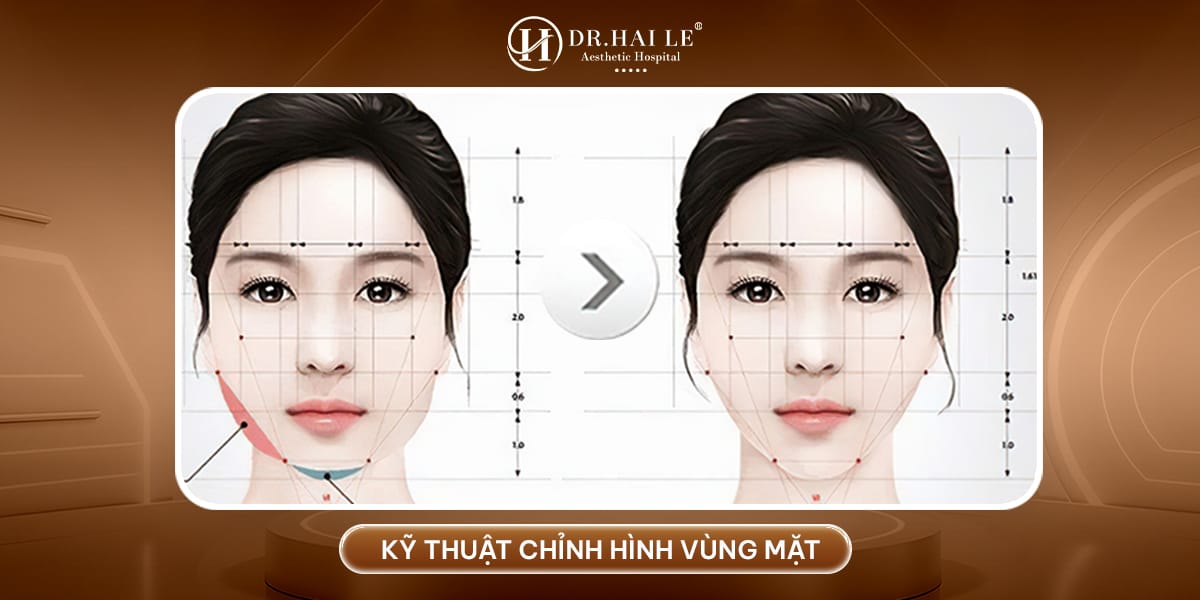 Kỹ thuật chỉnh hình vùng mặt tại Dr.Hải Lê