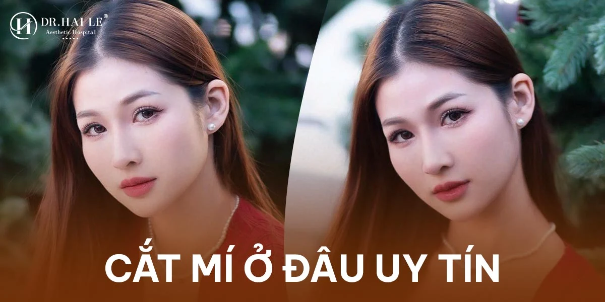 Dịch vụ cắt mí mắt chất lượng tại Dr.Hải Lê?