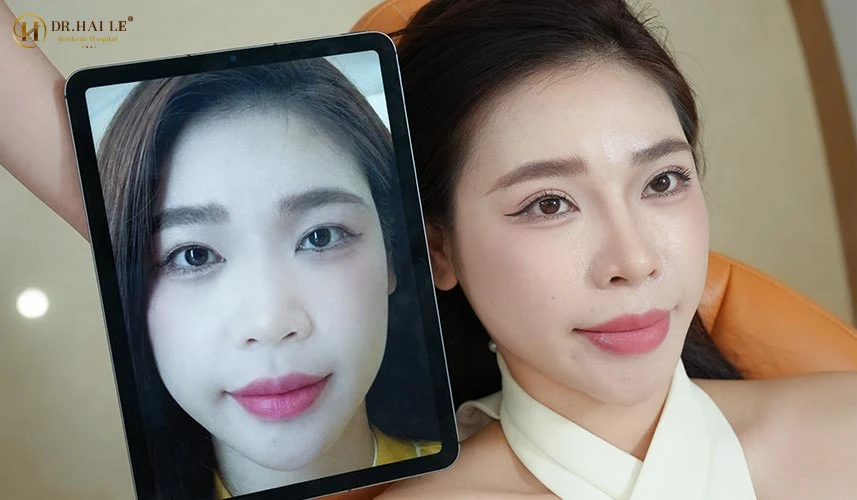 Bệnh viện Tạo hình Thẩm mỹ Dr.Hải Lê tự hào là trung tâm y khoa thẩm mỹ đạt tiêu chuẩn 5 sao, được Bộ Y tế cấp Giấy phép hoạt động