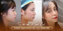 Diễn viên Khánh Linh và hành trình thăng hạng nhan sắc sau nâng mũi thẩm mỹ