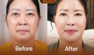 Khách hàng cải thiện làn da tươi sáng với tổ hợp medi rba