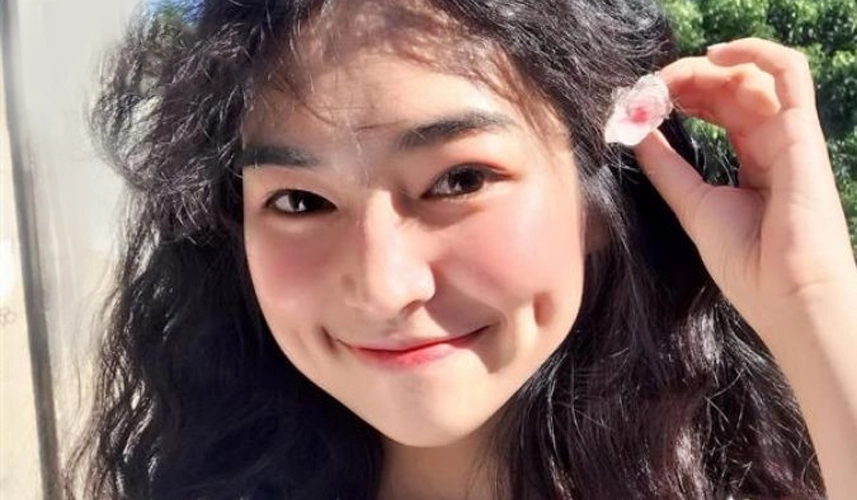 Luyện tập để có má lúm đồng tiền là phương pháp tác động lực cơ học bên ngoài lên vùng cơ gò má