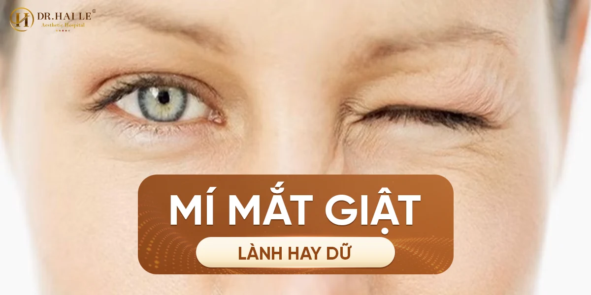 Mí mắt giật là điềm lành hay dữ?