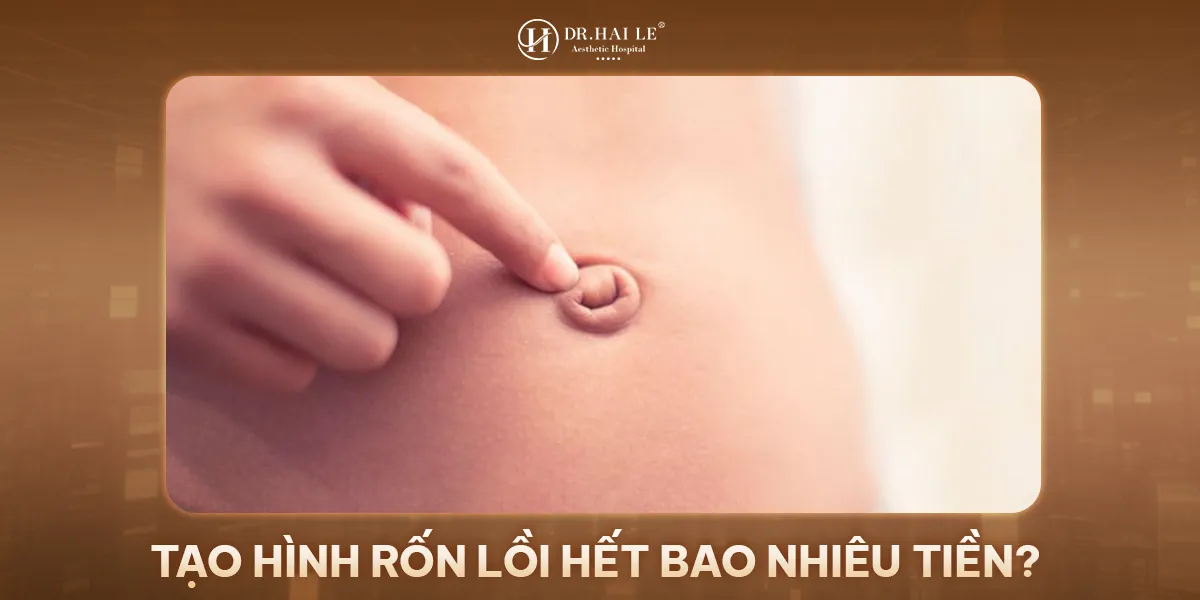 Thẩm mỹ tạo hình rốn lồi hết bao nhiêu tiền?