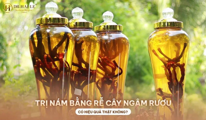 Trị nám bằng rễ cây ngâm rượu có hiệu quả thật không