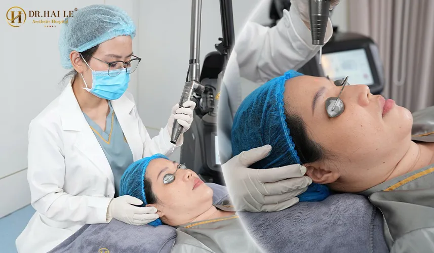 Trị nám tại Bệnh viện Tạo hình Thẩm mỹ Dr.Hải Lê