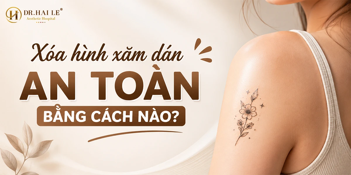 Xóa hình xăm dán an toàn bằng cách nào?
