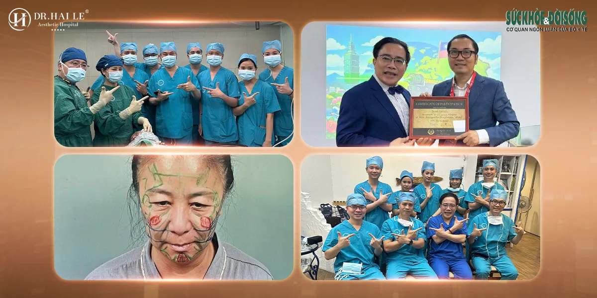 Sức khỏe và đời sống Căng da mặt - Khi trẻ hóa không còn là “kéo da”