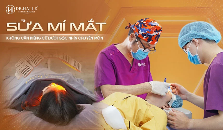 Sửa mí mắt không cần kiêng cữ dưới góc nhìn chuyên môn