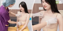 nâng ngực chuẩn y khoa được chuyên gia khuyến nghị