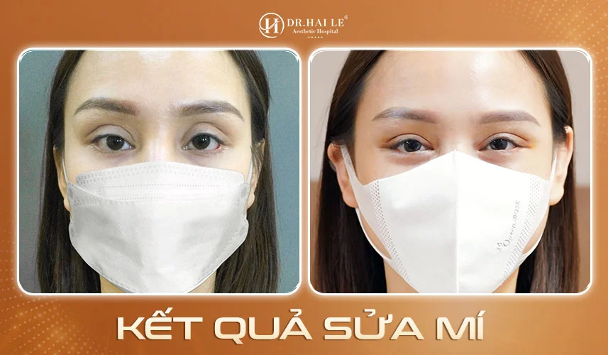 Công nghệ Healite-Leds và Plasma Gold